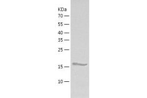 Western Blotting (WB) image for Ubiquitin-Conjugating Enzyme E2D 2 (UBE2D2) (AA 1-147) protein (His tag) (ABIN7286725) (UBE2D2 Protein (AA 1-147) (His tag))