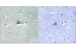 Immunohistochemistry analysis of paraffin-embedded human brain, using Claudin 5 (Phospho-Tyr217) Antibody.