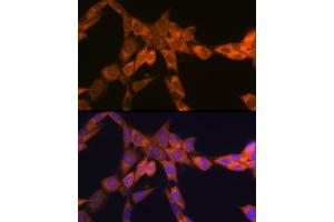 Immunofluorescence analysis of NIH-3T3 cells using 67 kDa Laminin Receptor Rabbit mAb (ABIN7270042) at dilution of 1:100 (40x lens). (RPSA/Laminin Receptor antibody)