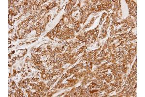 IHC-P Image Immunohistochemical analysis of paraffin-embedded SAS xenograft, using Calnexin, antibody at 1:100 dilution. (Calnexin antibody  (Internal Region))