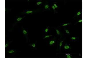Immunofluorescence of monoclonal antibody to MYNN on HeLa cell. (Myoneurin antibody  (AA 501-610))
