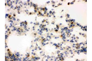 IHC analysis of Lipocalin 2 using anti-Lipocalin 2 antibody . (Lipocalin 2 antibody  (AA 21-200))