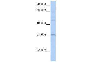 SLC39A11 antibody used at 1 ug/ml to detect target protein.