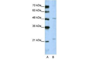 WDR12 antibody used at 5 ug/ml to detect target protein.
