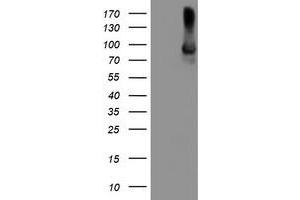 HEK293T cells were transfected with the pCMV6-ENTRY control (Left lane) or pCMV6-ENTRY ALOX15 (Right lane) cDNA for 48 hrs and lysed. (ALOX15 antibody)