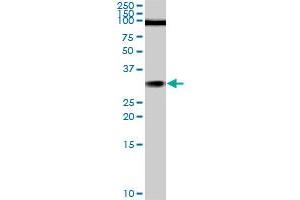 TGIF2 monoclonal antibody (M02), clone 5B11. (TGIF2 antibody  (AA 131-236))