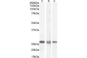 Western Blotting (WB) image for anti-RAN Binding Protein 1 (RANBP1) (C-Term) antibody (ABIN185257)