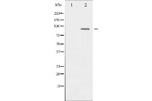 Western blot analysis of PKC alpha phosphorylation expression in UV treated NIH-3T3 whole cell lysates,The lane on the left is treated with the antigen-specific peptide. (PKC alpha antibody  (pThr638))