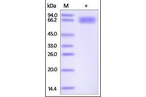 Human Axl, His Tag on SDS-PAGE under reducing (R) condition. (AXL Protein (AA 26-449) (His tag))