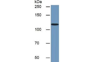 Rabbit Detection antibody from the kit in WB with Positive Control:  Sample Human Jurkat lysate. (CD31 ELISA Kit)