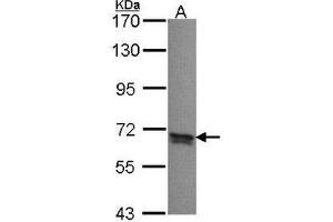 Western Blot analysis: PPP2R5B antibody staining of A431 whole cell lysate (30 µg) at 1/1000 dilution, 7. (PPP2R5B antibody  (C-Term))