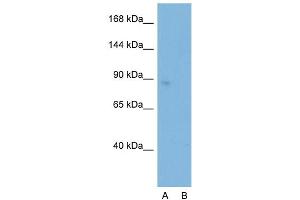 Host:  Rabbit  Target Name:  SATB1  Sample Type:  Jurkat  Lane A:  Primary Antibody  Lane B:  Primary Antibody + Blocking Peptide  Primary Antibody Concentration:  0. (SATB1 antibody  (C-Term))