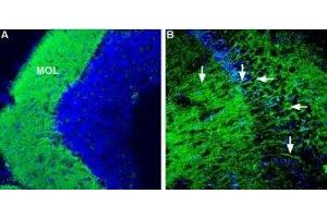 Expression of Corticotropin-releasing factor receptor 1 in mouse brain - Immunohistochemical staining of mouse hippocampus and mouse cerebellum using Anti-CRF1/CRHR1 (extracellular) Antibody (ABIN7043086, ABIN7044185 and ABIN7044186), (1:600). (CRHR1 antibody  (Extracellular, N-Term))