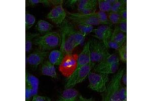 Immunofluorescence staining of methanol-fixed Hela using NFkB-p65(Phospho-Thr254) Antibody. (NF-kB p65 antibody  (pThr254))
