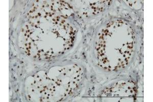 Image no. 1 for anti-Tousled-Like Kinase 1 (TLK1) (AA 111-230) antibody (ABIN599099) (TLK1 antibody  (AA 111-230))