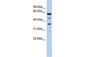 Image no. 1 for anti-RD RNA Binding Protein (RDBP) (AA 35-84) antibody (ABIN6742975) (RDBP antibody  (AA 35-84))