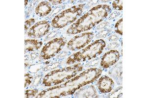 Immunohistochemistry (IHC) image for anti-Alkaline Phosphatase, Liver/bone/kidney (ALPL) (AA 150-250) antibody (ABIN6136824)