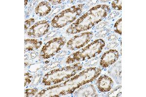 Immunohistochemistry of paraffin-embedded mouse kidney using Alkaline Phosphatase (Alkaline Phosphatase (ALPL)) Rabbit pAb (ABIN6133557, ABIN6136824, ABIN6136825 and ABIN6216013) at dilution of 1:200 (40x lens). (ALPL antibody  (AA 150-250))