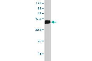 Western Blot detection against Immunogen (36. (PIK3C2G antibody  (AA 2-100))