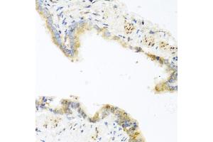 Immunohistochemistry of paraffin-embedded mouse lung using RETN antibody (ABIN5974977) at dilution of 1/100 (40x lens). (Resistin antibody)