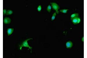 Immunofluorescent analysis of MCF-7 cells using ABIN7163177 at dilution of 1:100 and Alexa Fluor 488-congugated AffiniPure Goat Anti-Rabbit IgG(H+L) (PREX1 antibody  (AA 1-44))
