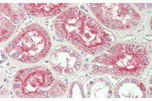 Detection of ALT in Human Kidney Tissue using Polyclonal Antibody to Alanine Aminotransferase (ALT) (ALT antibody  (AA 147-263))