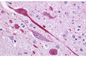 Immunohistochemical (Formalin/PFA-fixed paraffin-embedded sections) staining in human brain, neurons and glia with P2RY14 polyclonal antibody . (P2RY14 antibody  (C-Term))