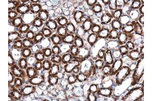 IHC-P Image ILK antibody [N1C1] detects ILK protein at cytoplasm in mouse kidney by immunohistochemical analysis. (ILK antibody)