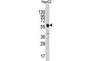 Western Blotting (WB) image for anti-Thymidine Phosphorylase (TYMP) antibody (ABIN3003120) (Thymidine Phosphorylase antibody)
