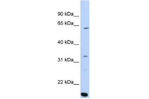 ARID5A antibody used at 0. (ARID5A antibody  (C-Term))