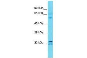 Host: Rabbit Target Name: TMEM182 Sample Type: Fetal Liver lysates Antibody Dilution: 1. (TMEM182 antibody  (N-Term))