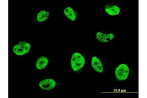 Immunofluorescence of monoclonal antibody to HES2 on HeLa cell. (HES2 antibody  (AA 41-114))