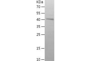 Western Blotting (WB) image for Gasdermin D (GSDMD) (AA 276-484) protein (His-IF2DI Tag) (ABIN7123056) (GSDMD Protein (AA 276-484) (His-IF2DI Tag))
