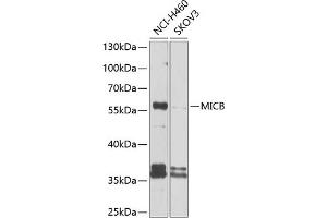 Western blot analysis of extracts of various cell lines, using MICB antibody (ABIN6133301, ABIN6143831, ABIN6143832 and ABIN6225101) at 1:1000 dilution. (MICB antibody  (AA 23-108))