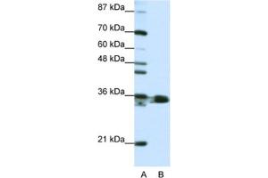 Western Blotting (WB) image for anti-Heterogeneous Nuclear Ribonucleoprotein A1 (HNRNPA1) antibody (ABIN2462116) (HNRNPA1 antibody)