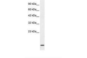 Image no. 2 for anti-Homeobox A1 (HOXA1) (C-Term) antibody (ABIN202024) (HOXA1 antibody  (C-Term))