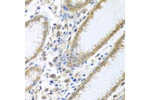 Immunohistochemistry of paraffin-embedded human stomach using EIF4E antibody (ABIN5971189) at dilution of 1/100 (40x lens). (EIF4E antibody)