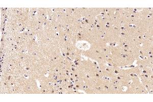 Detection of BDNF in Porcine Cerebrum Tissue using Polyclonal Antibody to Brain Derived Neurotrophic Factor (BDNF) (BDNF antibody  (AA 20-252))