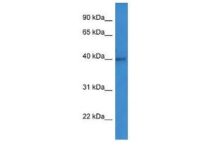 Western Blot showing ART1 antibody used at a concentration of 1-2 ug/ml to detect its target protein. (ART1 antibody  (C-Term))