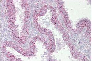 Immunohistochemistry with Uterus tissue at an antibody concentration of 5µg/ml using anti-CDK9 antibody (AVARP03004_P050) (CDK9 antibody  (N-Term))