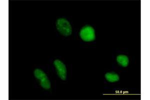 Immunofluorescence of purified MaxPab antibody to TRUB1 on HeLa cell.