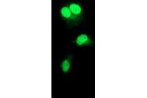 Anti-RAD51L1 mouse monoclonal antibody (ABIN2455028) immunofluorescent staining of COS7 cells transiently transfected by pCMV6-ENTRY RAD51L1 (RC206457). (RAD51 Homolog B antibody  (AA 119-346))