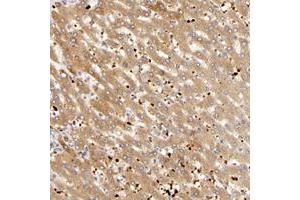 Immunohistochemical staining of human liver with AGT polyclonal antibody  shows moderate cytoplasmic positivity in hepatocytes.