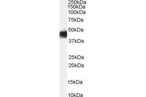 Western Blotting (WB) image for Cerebral Cavernous Malformation 2 (CCM2) peptide (ABIN369275) (Cerebral Cavernous Malformation 2 (CCM2) Peptide)