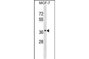 Western blot analysis in MCF-7 cell line lysates (35ug/lane). (MRPL2 antibody  (C-Term))