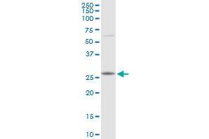 Western Blotting (WB) image for anti-RAB23, Member RAS Oncogene Family (RAB23) (AA 1-237) antibody (ABIN526878)