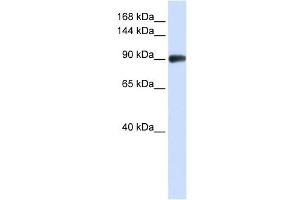 RAD54B antibody used at 1 ug/ml to detect target protein. (RAD54B antibody)
