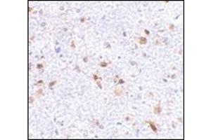 Immunohistochemistry of PDL-2 in mouse brain tissue with this product at 2. (PDCD1LG2 antibody  (Center))