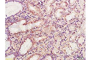 Formalin-fixed and paraffin embedded human gastric mucosa labeled with Anti-MMP-3 Polyclonal Antibody (ABIN668301), Unconjugated at 1:200, followed by conjugation to the secondary antibody and DAB staining (MMP3 antibody  (AA 401-477))