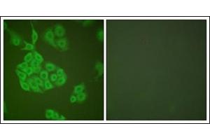 Immunofluorescence analysis of A549 cells, using MMP-11 Antibody. (MMP11 antibody  (Internal Region))